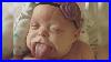 This_Baby_Was_Born_With_A_Rare_Disorder_That_Made_Her_Tongue_Twice_As_Big_As_Her_Mouth_01_km